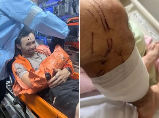 An image collage containing 2 images, Image 1 shows NINTCHDBPICT001032557459, Image 2 shows NINTCHDBPICT001032556876