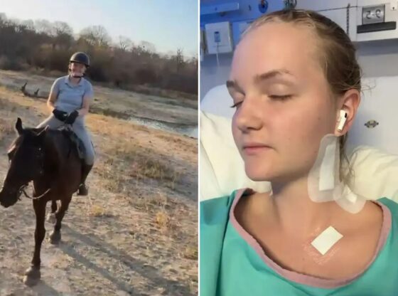 An image collage containing 2 images, Image 1 shows NINTCHDBPICT001037579575, Image 2 shows Injured Naemi Boy after being bitten in the neck by a lion